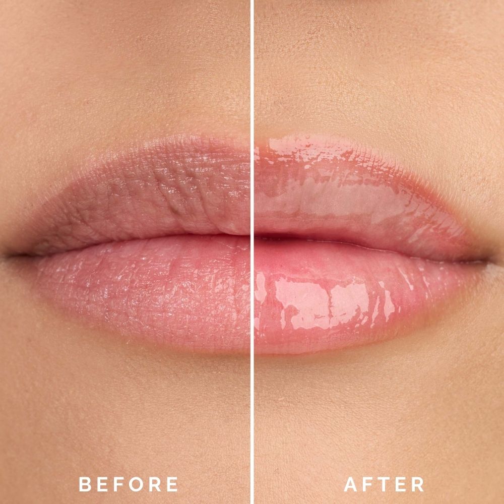 HYUE HydraGlow™  Day & Night Lip Treatment